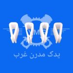 خار نگهدارنده زیر شیشه خودرو - 405 پارس و انواع سمند ( 10 عددی )